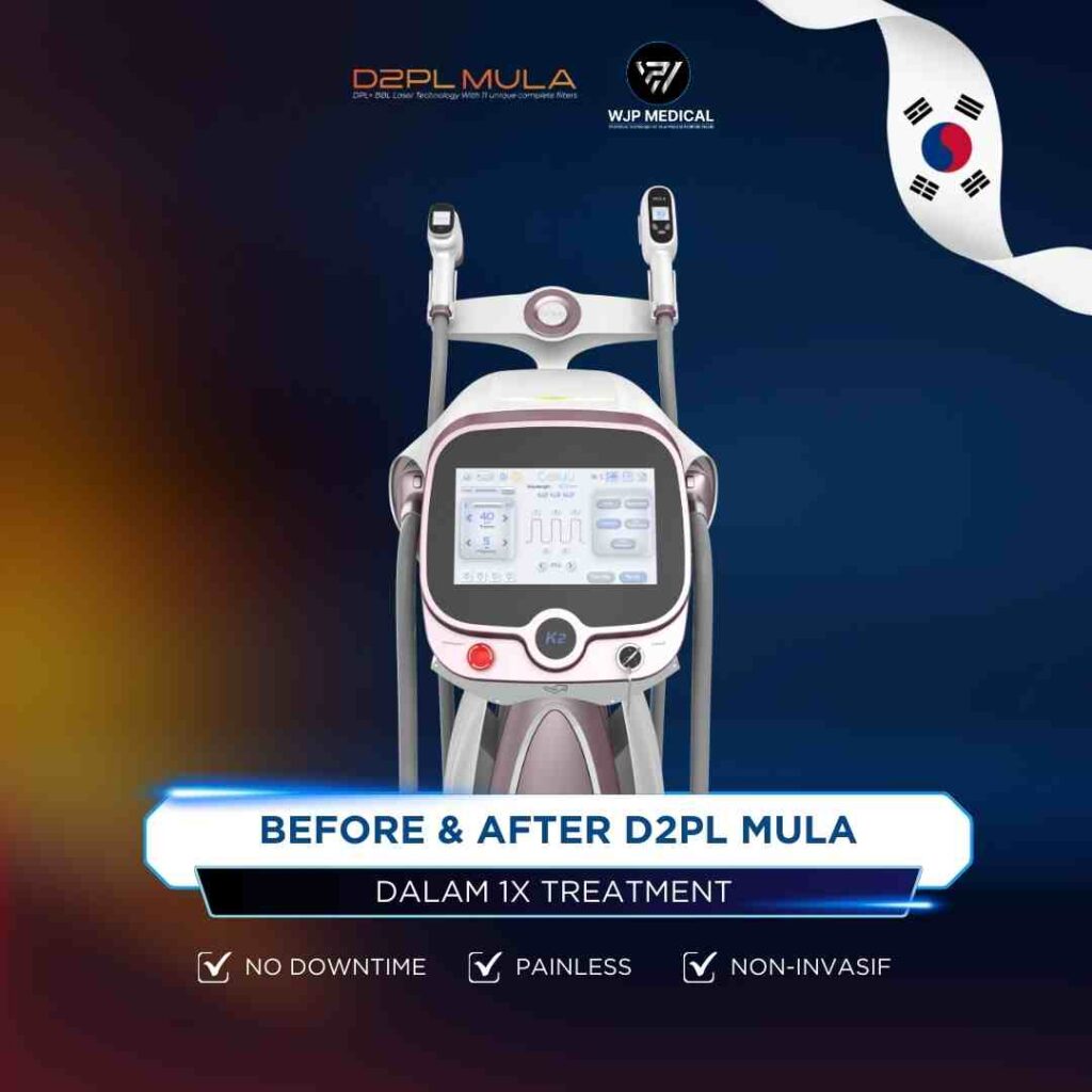 D2PL MULA ipl teknologi terbaru