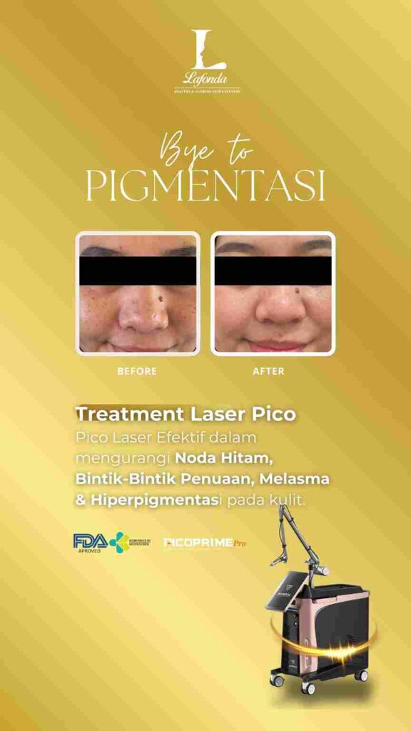 PICO PRIME