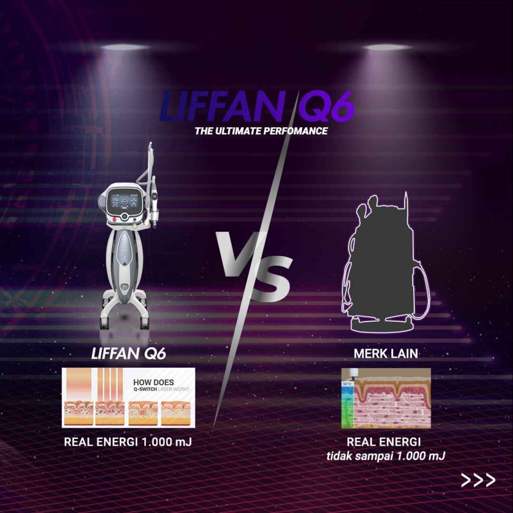 Bingung Pilih Laser untuk Klinik? LIFFAN Q6 Solusi Terbaik untuk Bisnis Anda!