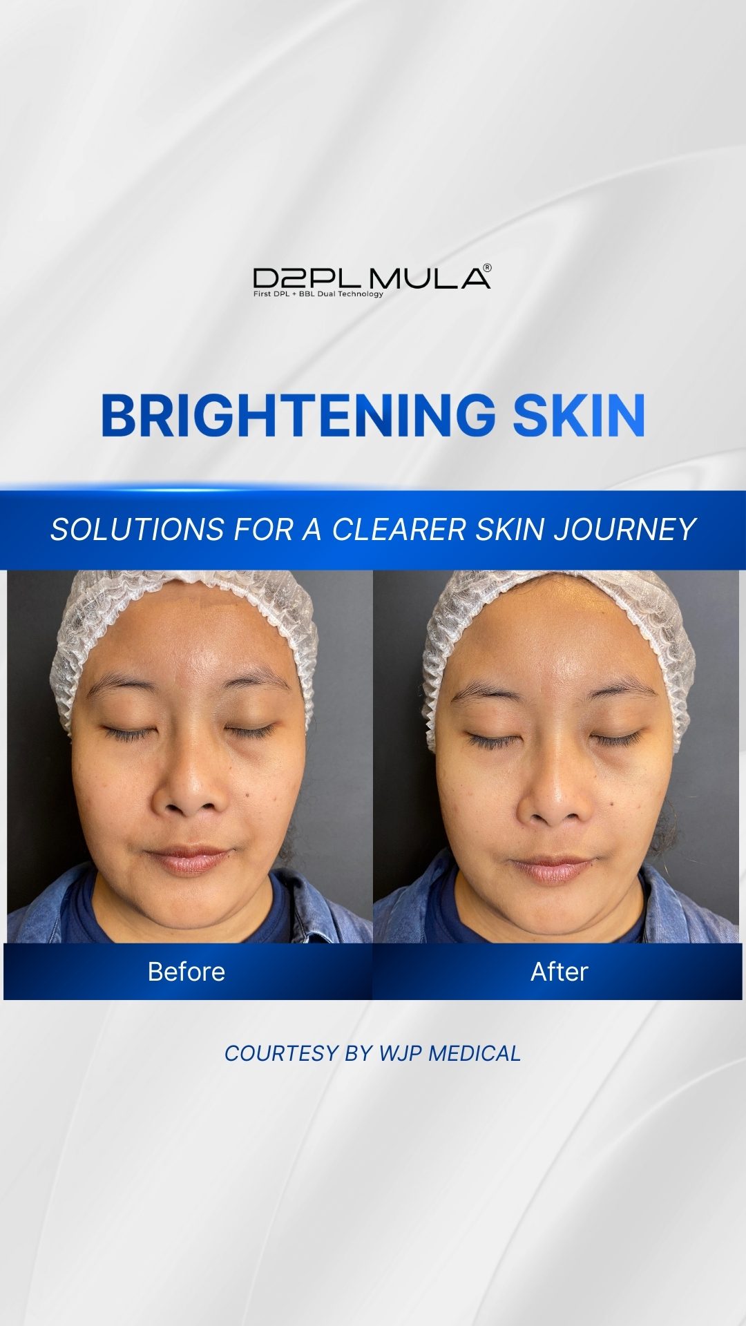 COVER REELS BEFORE AFTER BRIGHTENING SKIN