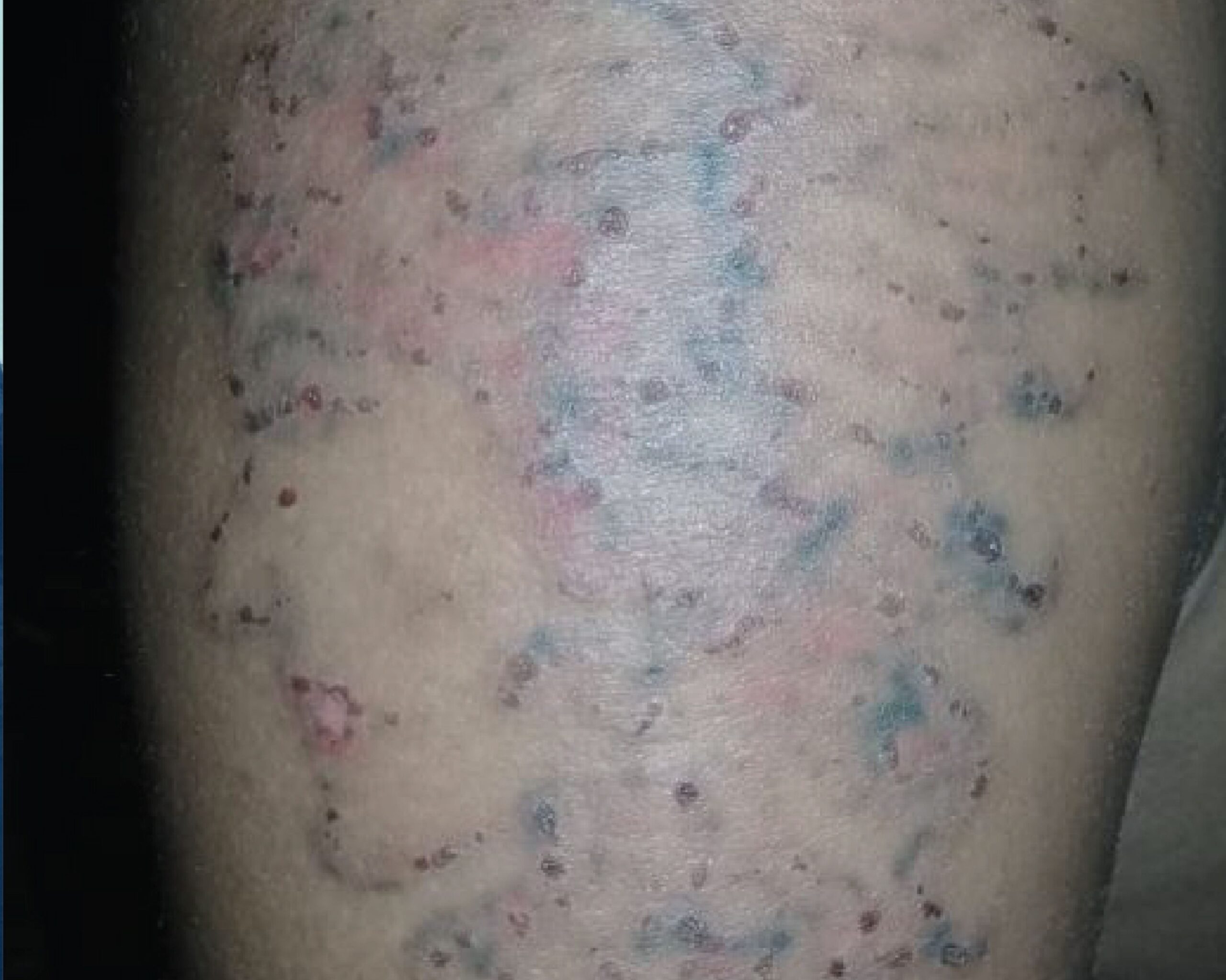 After Image