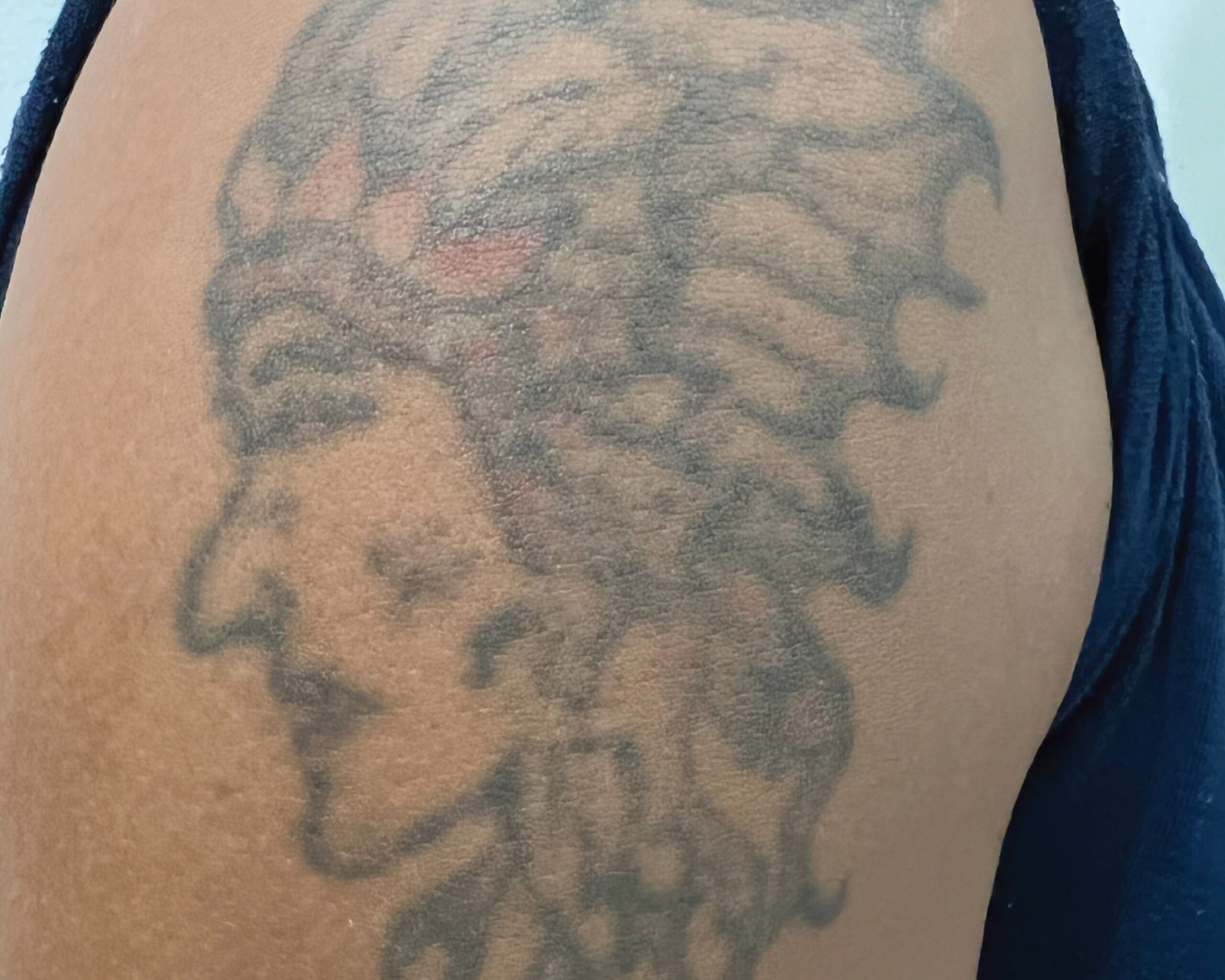 Before Image