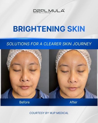 COVER REELS BEFORE AFTER BRIGHTENING SKIN